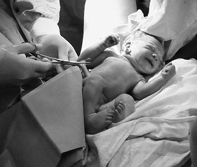 Warum es nicht sinnvoll ist, Nabelschnurblut einzulagern.